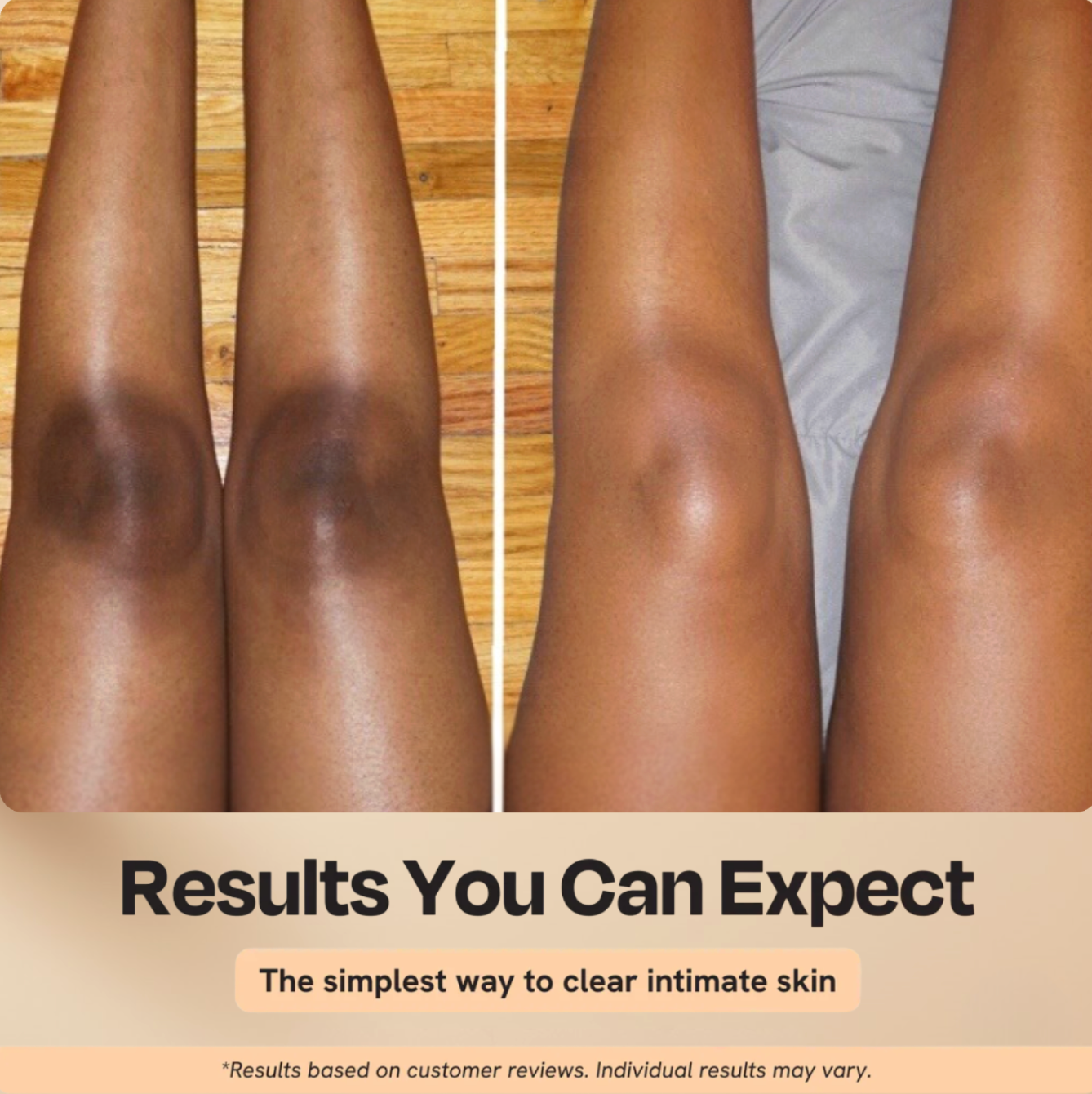 Peel Shot Body Spray