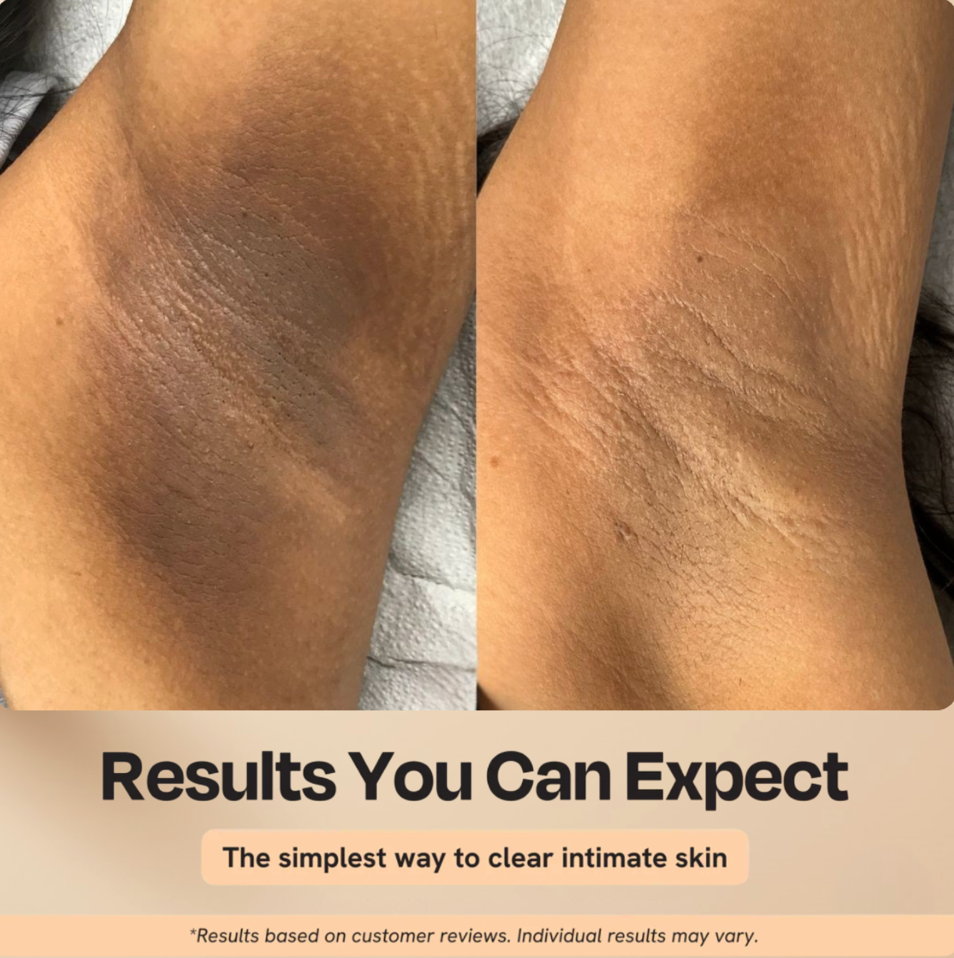 Peel Shot Body Spray